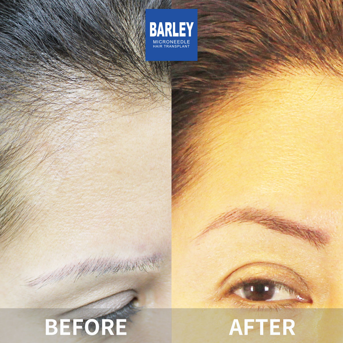 Natural Results