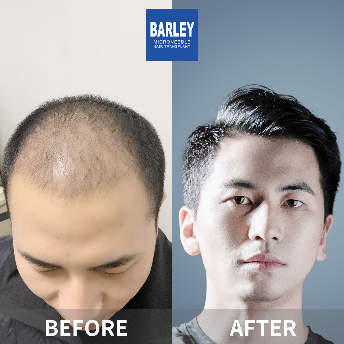 Healthy Scalp