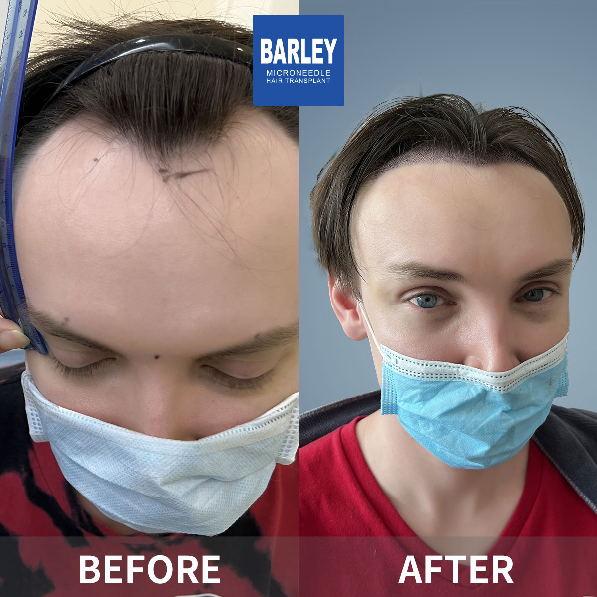 Stronger Hair