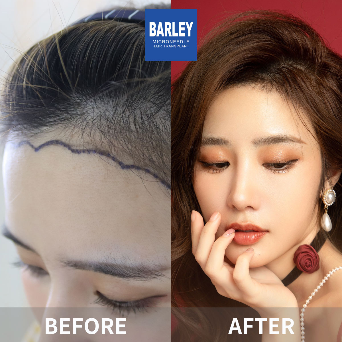 Thicker Strands