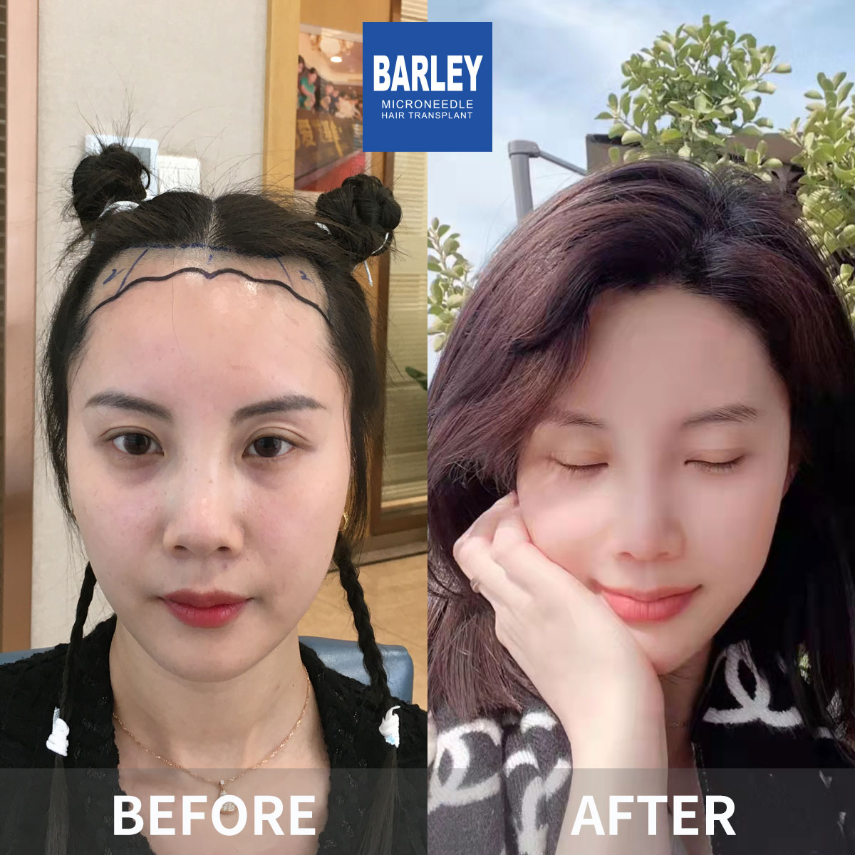 Thicker Hair